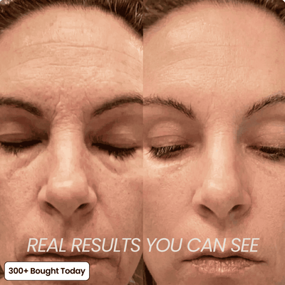 Transform Wrinkles, Fine Lines, And Tired Creases Naturally