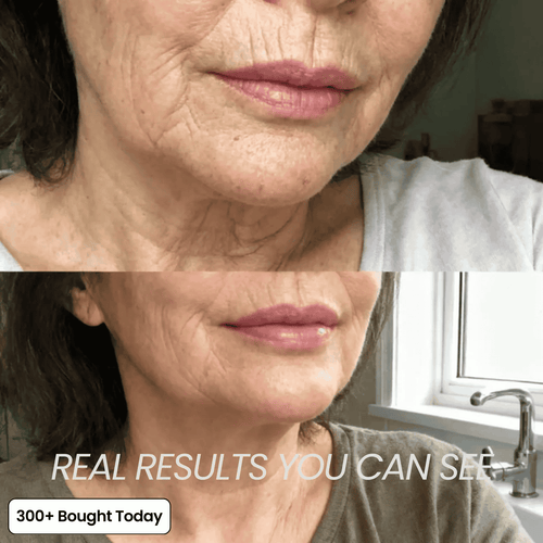 Transform Wrinkles, Fine Lines, And Tired Creases Naturally