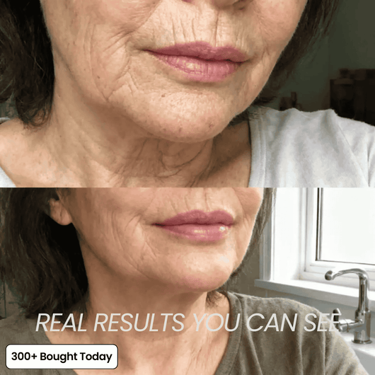 Transform Wrinkles, Fine Lines, And Tired Creases Naturally